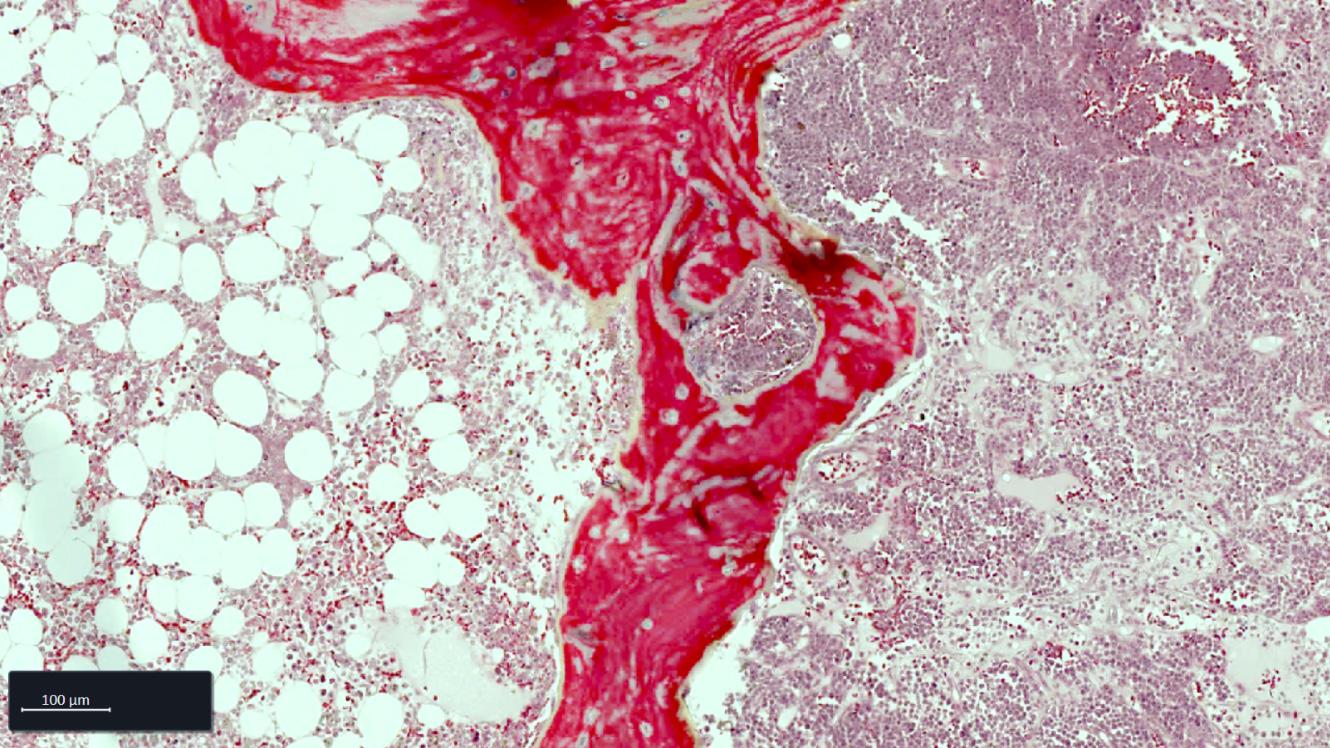 Bone Marrow FFPE tissue section stained with movat staining