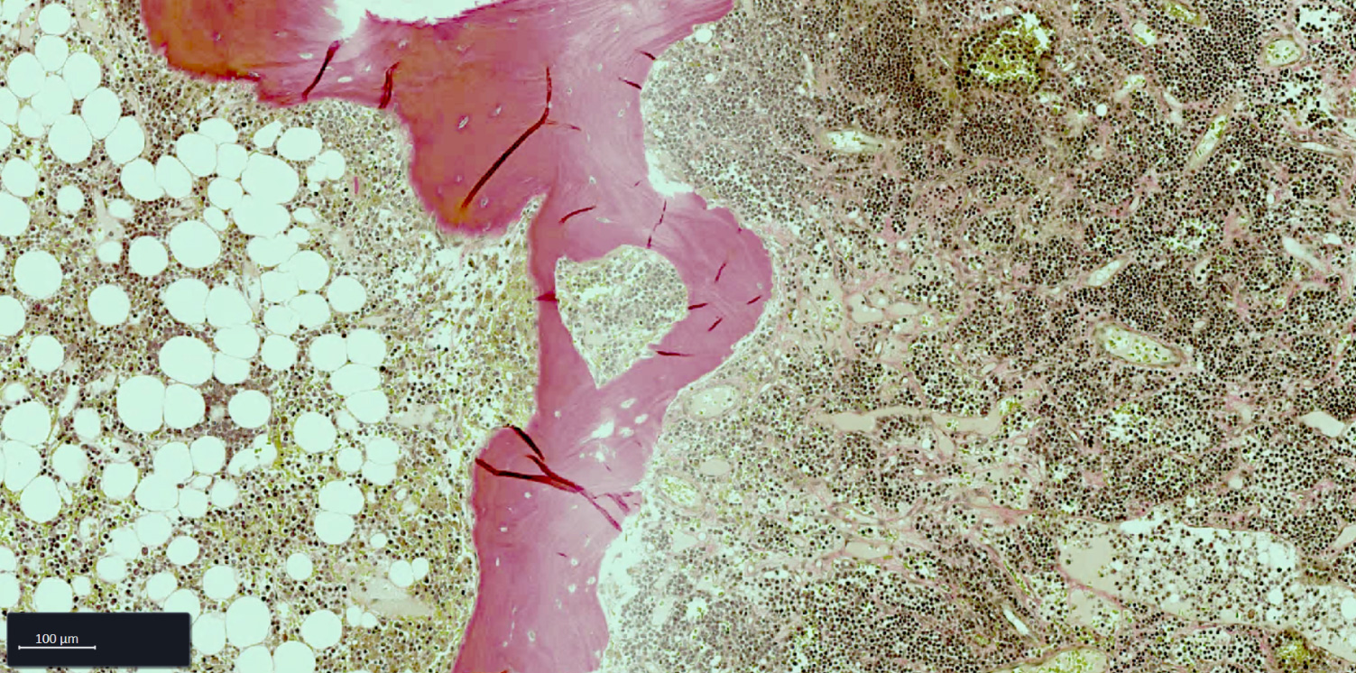 Bone Marrow FFPE tissue section stained with Weigert-Van Gieson (WvG) staining.