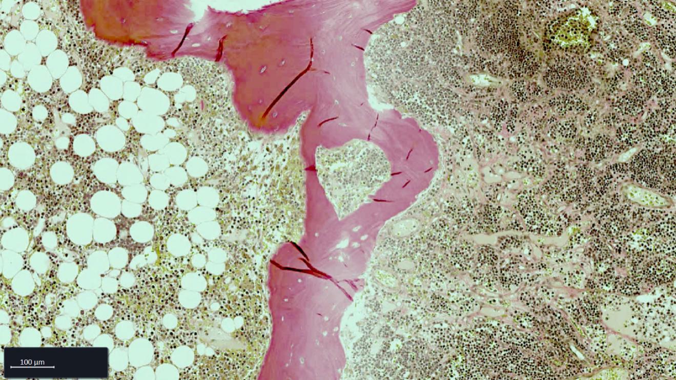Bone Marrow FFPE tissue section stained with Weigert-Van Gieson (WvG) staining.