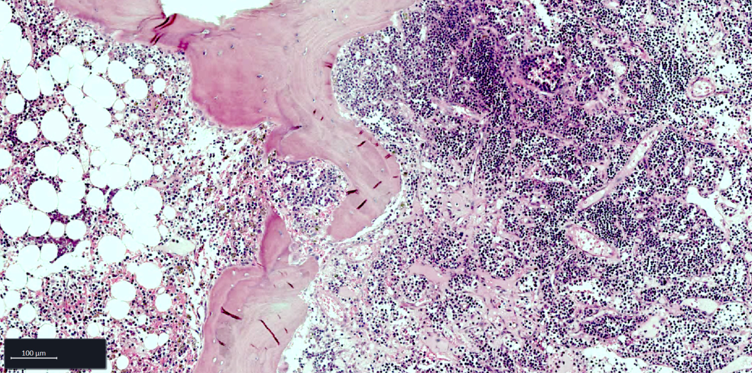 Bone Marrow FFPE tissue section stained with Hematoxylin and Eosin (H&E) staining