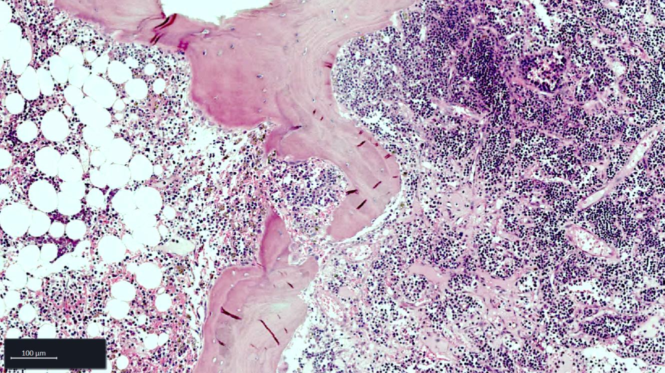 Bone Marrow FFPE tissue section stained with Hematoxylin and Eosin (H&E) staining