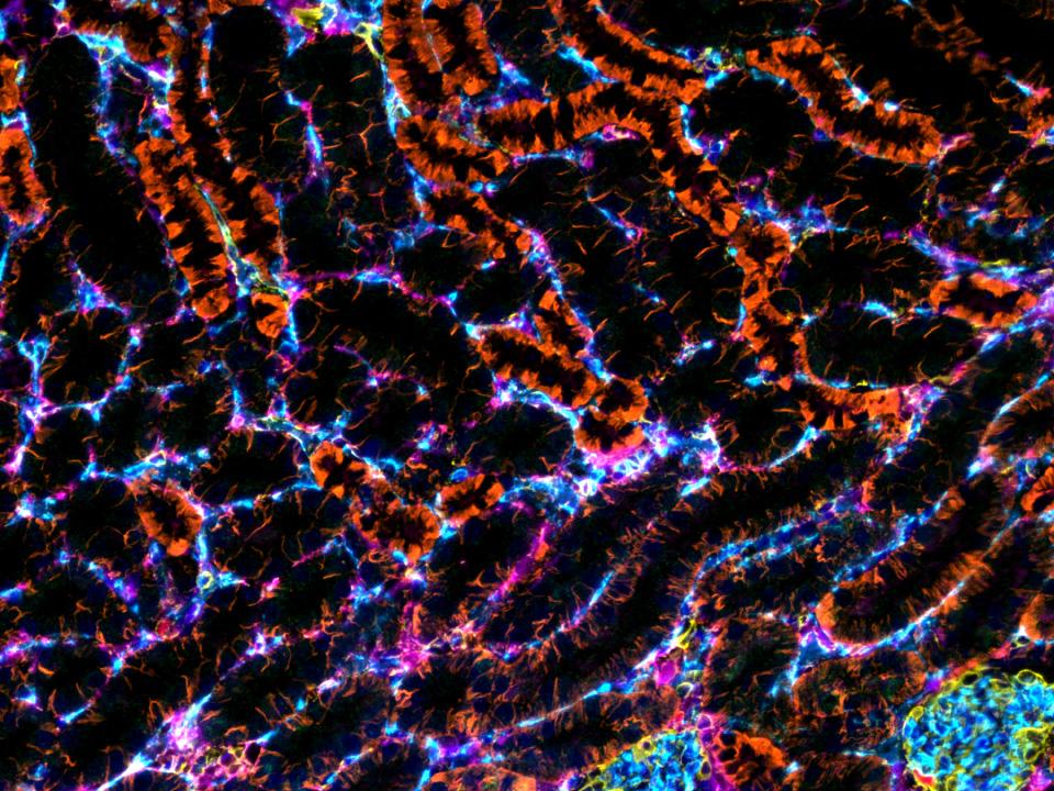 A mouse liver FFPE tissue section. Picture detail.