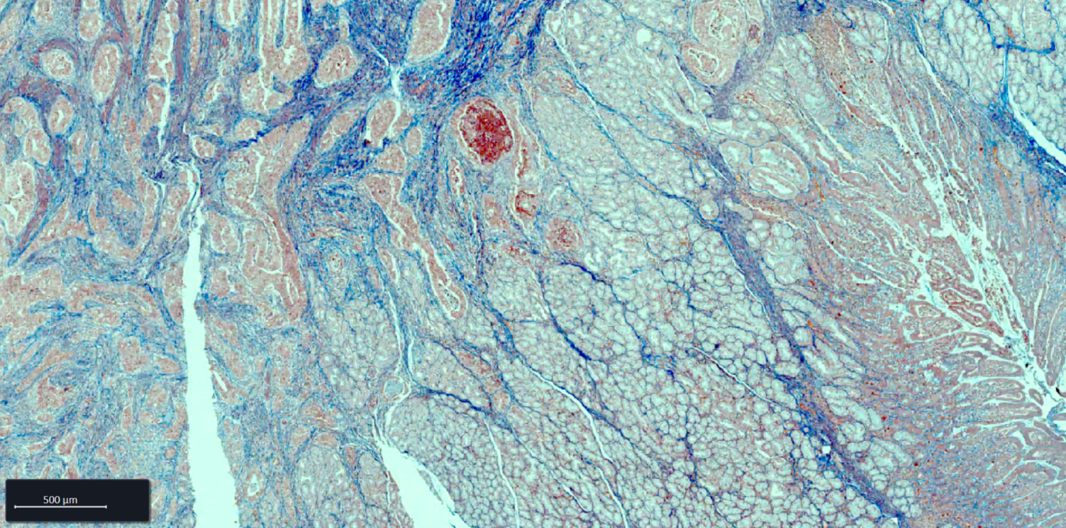 Esophagus FFPE tissue section stained with AZAN staining