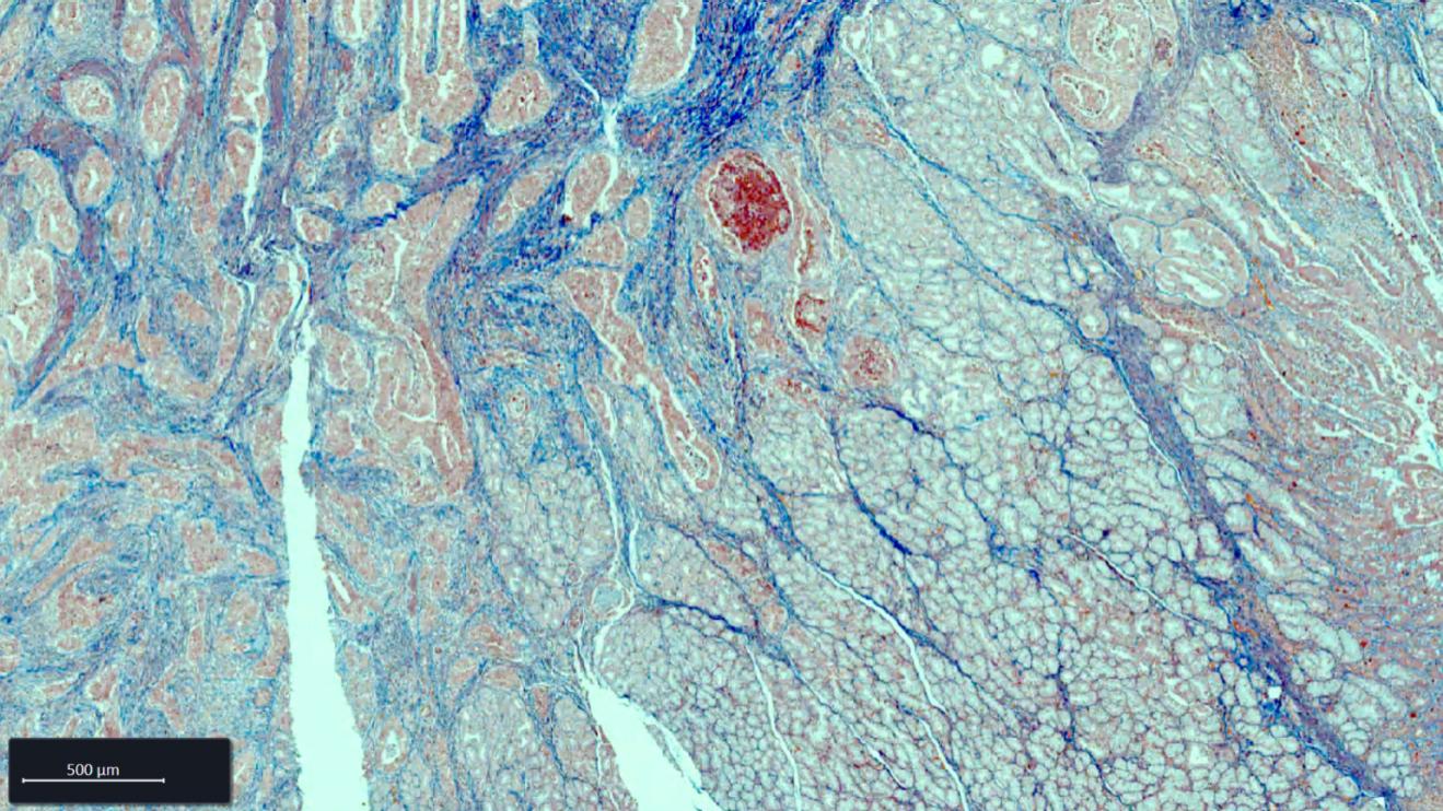Esophagus FFPE tissue section stained with AZAN staining