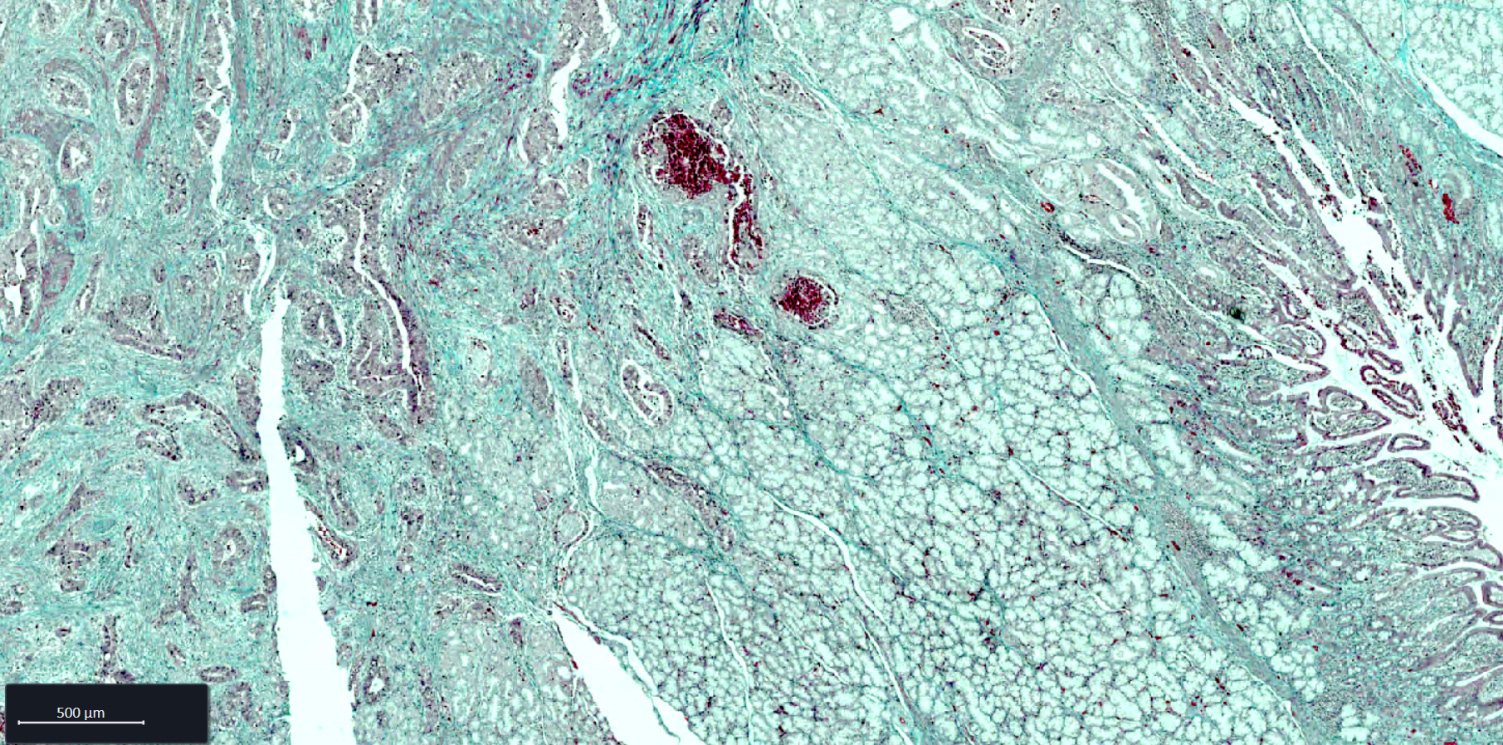 Esophagus FFPE tissue section stained with Goldner staining