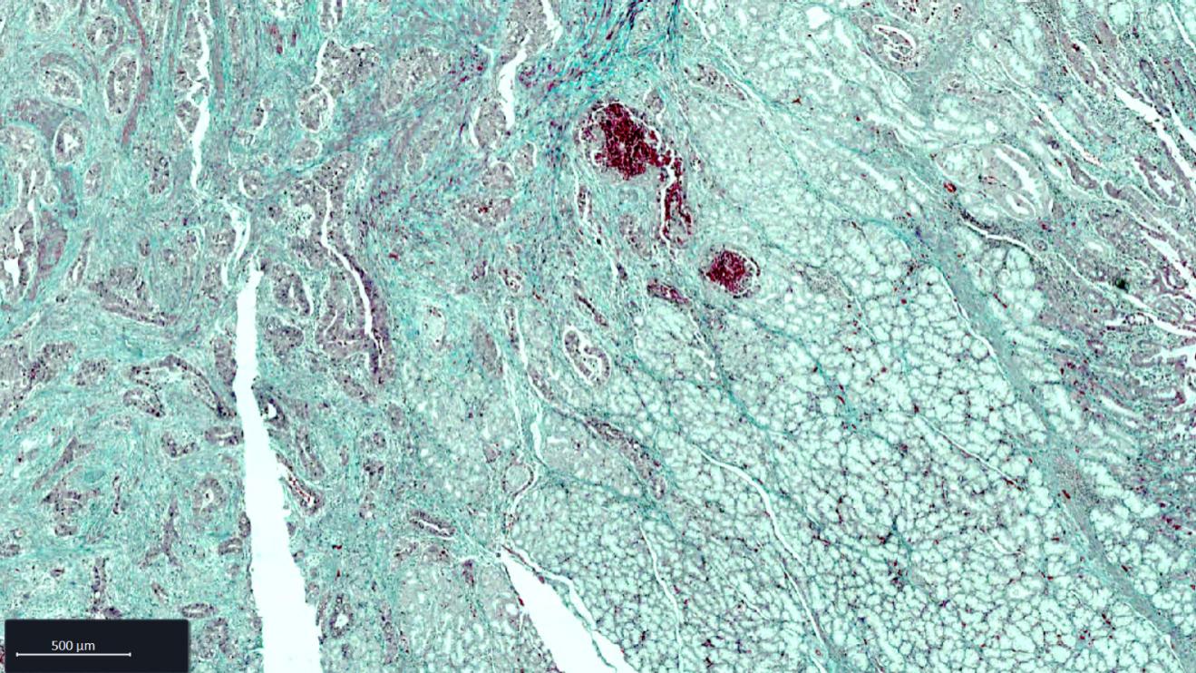 Esophagus FFPE tissue section stained with Goldner staining