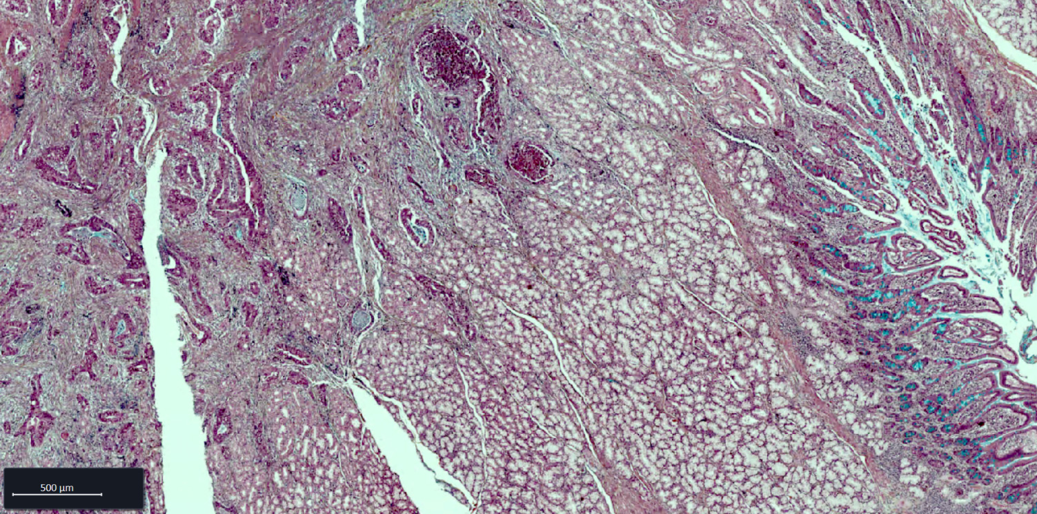 Esophagus FFPE tissue section stained with Movat staining