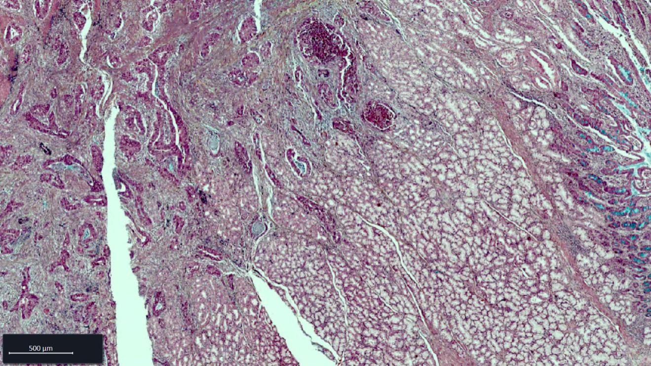 Esophagus FFPE tissue section stained with Movat staining