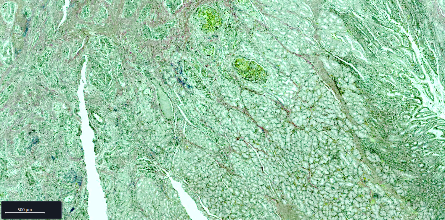 Esophagus FFPE tissue section stained with Weigert-Van Gieson (WvG) staining