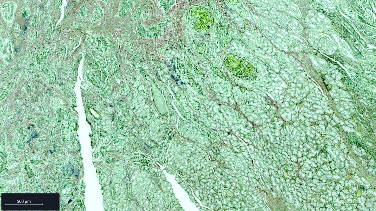 Esophagus FFPE tissue section stained with Weigert-Van Gieson (WvG) staining
