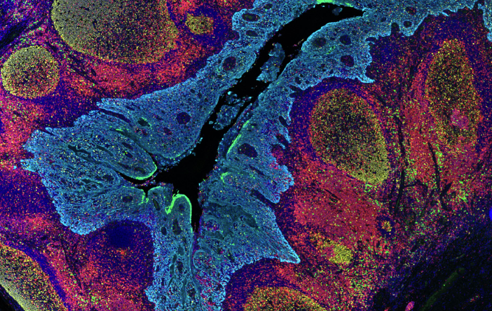 Human tonsil FFPE tissue section stained with Ki67, GranzymeB, CD3, CK/SOX10, DAPI.