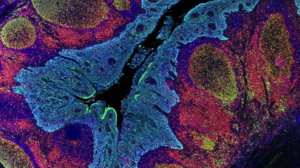Human tonsil FFPE tissue section stained with Ki67, GranzymeB, CD3, CK/SOX10, DAPI.