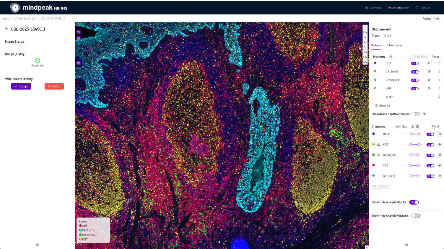 Screenshot of an image viewer in Mindpeak, showing image quality accepted