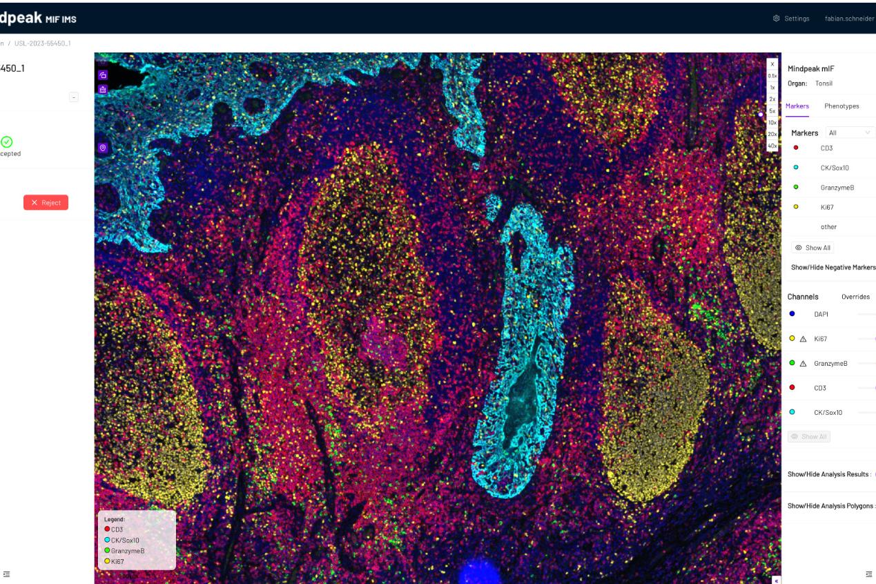Image viewer with quality accepted