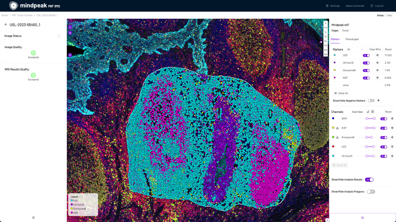 Screenshot of an image viewer in Mindpeak, showing the marker display and the results