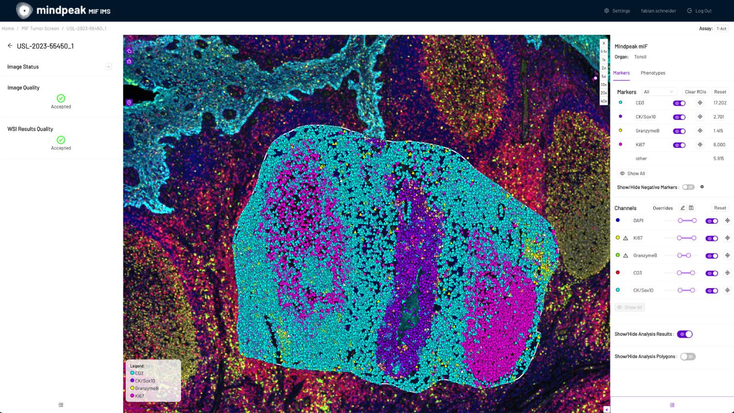 Screenshot of an image viewer in Mindpeak, showing the marker display and the results