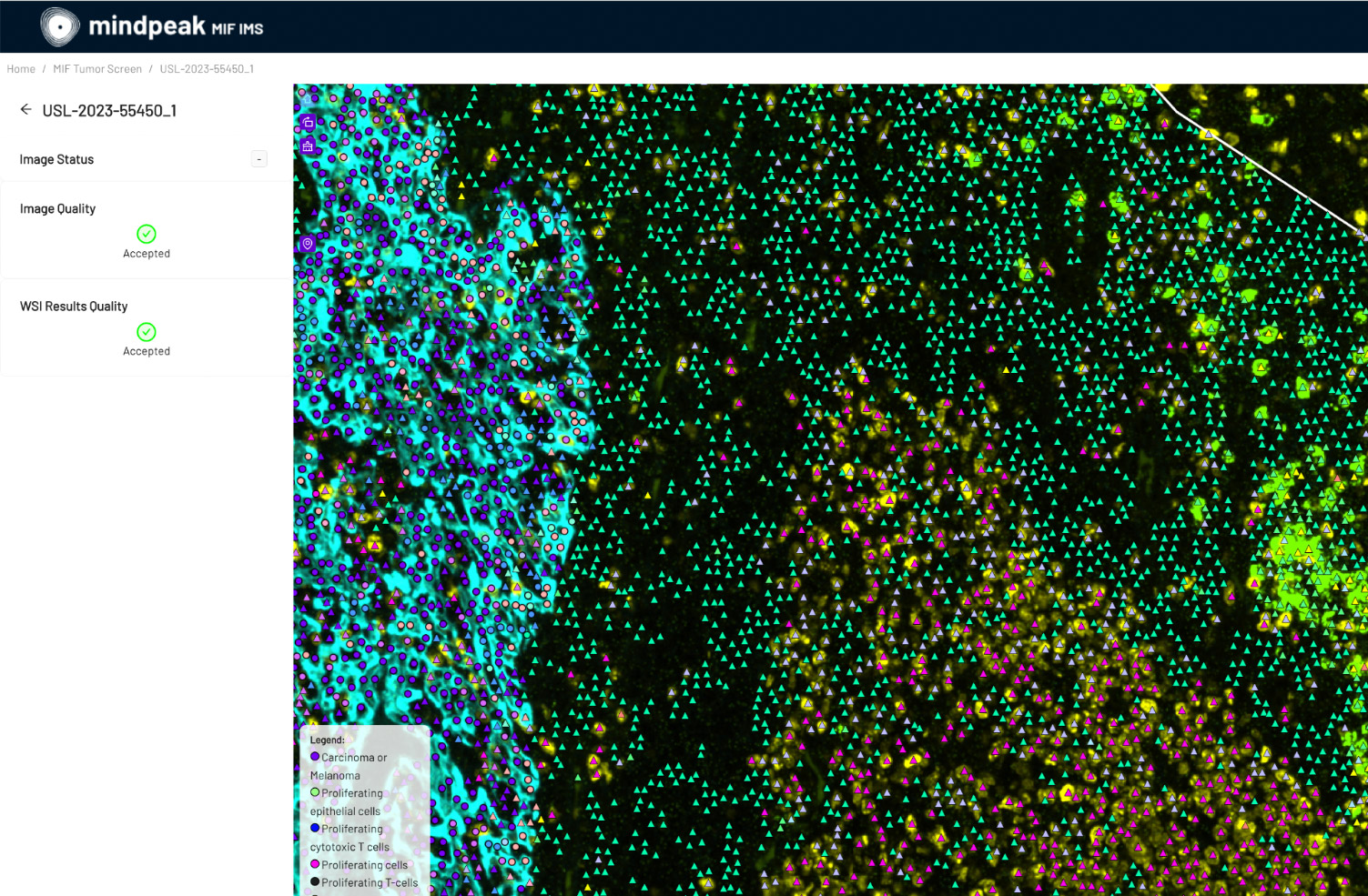 Screenshot of an image viewer in Mindpeak, with phenotypes zoomed in