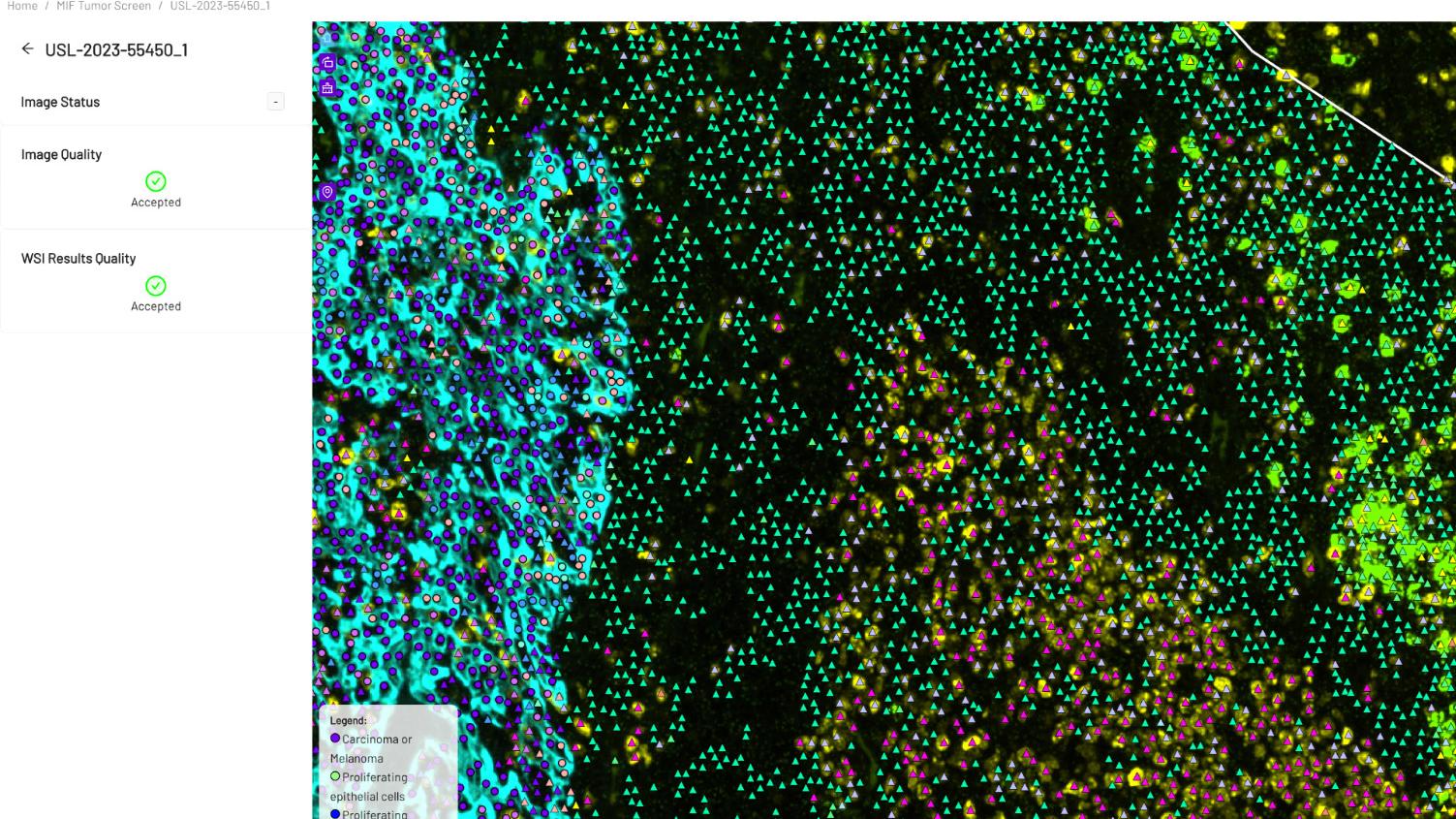 Screenshot of an image viewer in Mindpeak, with phenotypes zoomed in