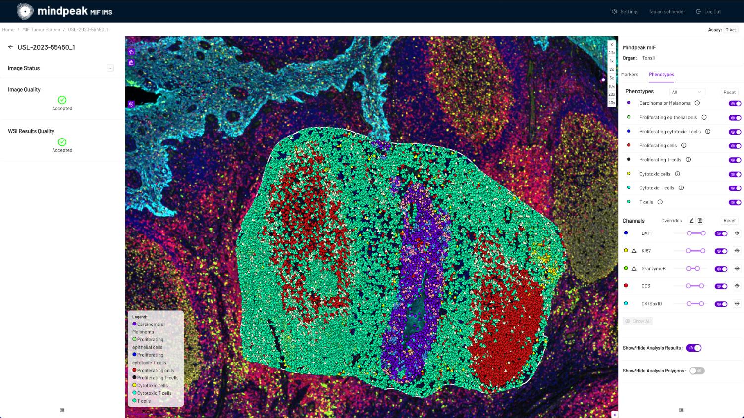 Screenshot of an image viewer in Mindpeak, showing phenotypes