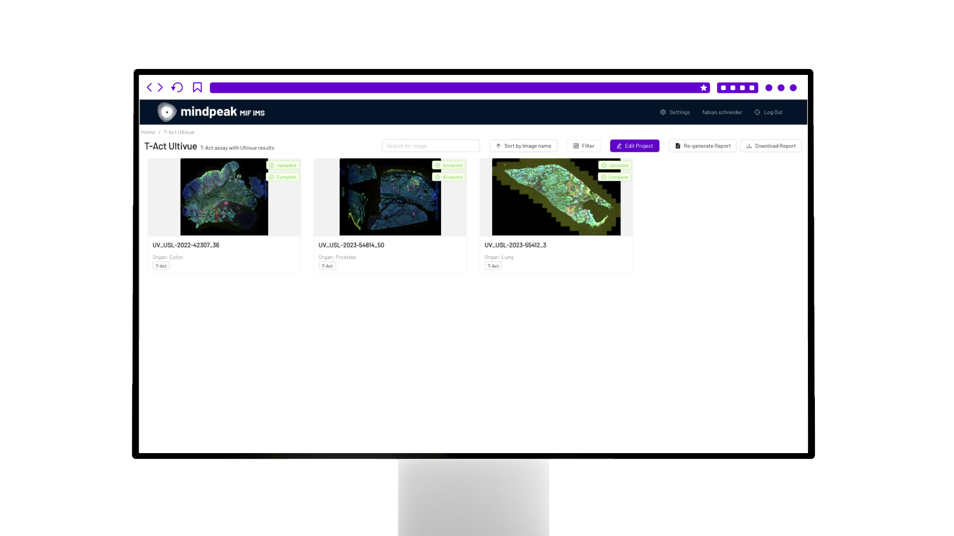 Screenshot of a Mindpeak project image overview named mIF Tumor Screen