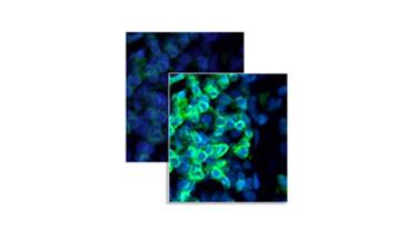 High Quality Multiplex Data