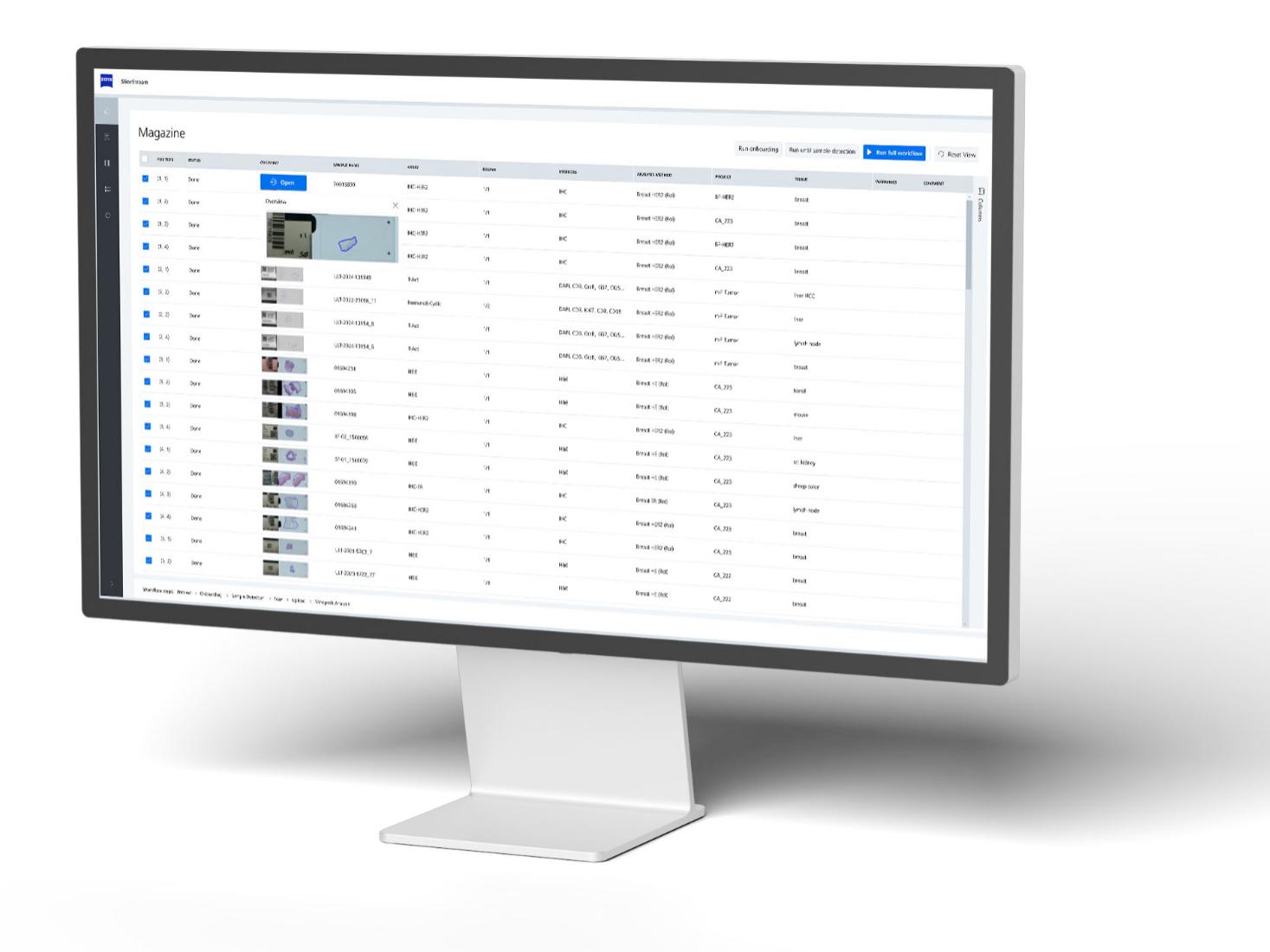 Screenshot of SlideStream, intuitive workflow manager software for scan and analysis automation 