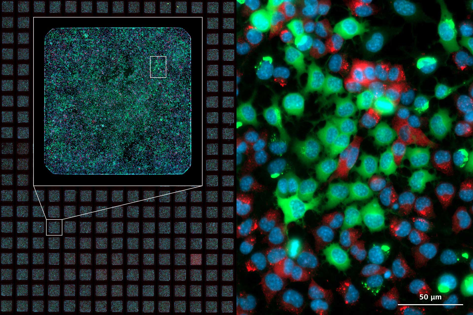 384 microwell plate imaged with different magnifications in 3 channels.