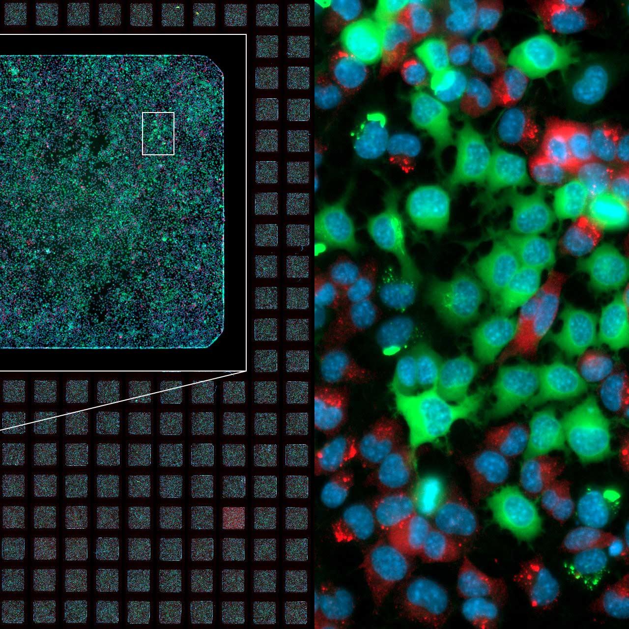 Image d'une plaque de microtitration à 384 cupules réalisée à différents grossissements et selon 3 canaux.