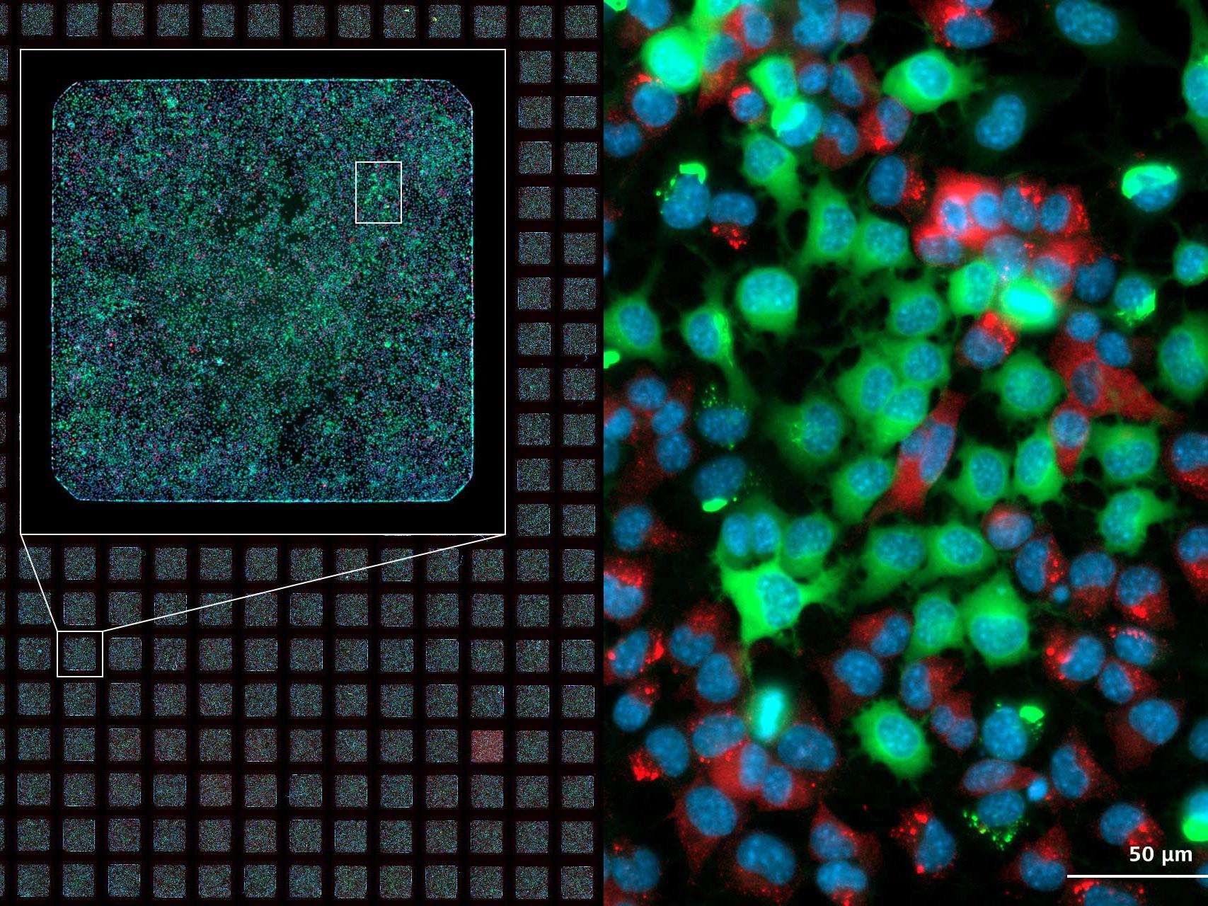 Image d'une plaque de microtitration à 384 cupules réalisée à différents grossissements et selon 3 canaux.