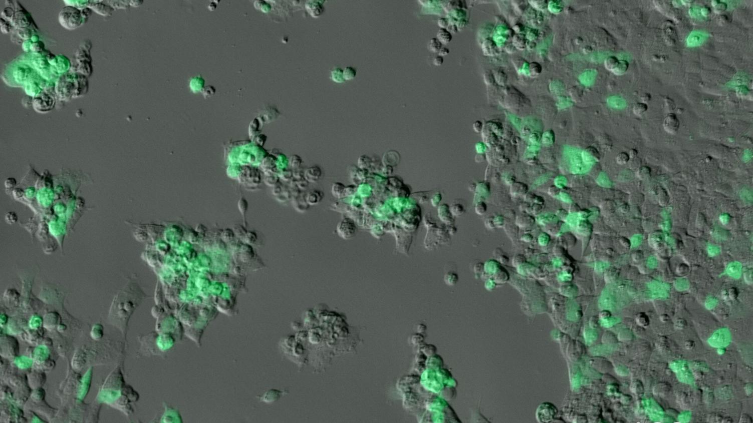 GFP HEK (Human Embryonic Kidney) cells. Imaged through a 1 mm plastic bottom; images taken every 5 minutes for a total of 5 days.