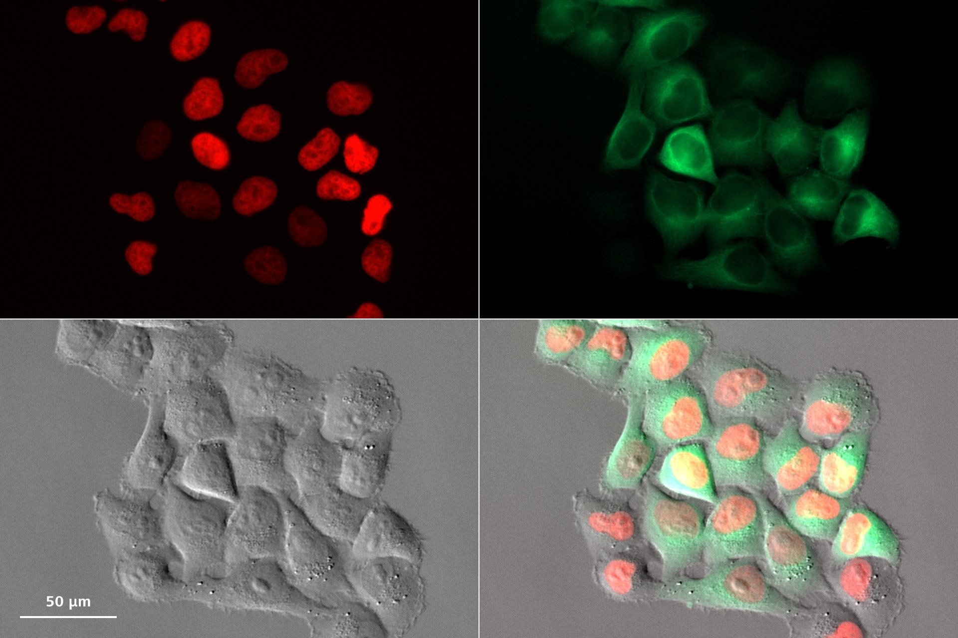 HeLa Kyoto cell growth assay imaged every 15 minutes for 72 hours using Autoimmersion. 
