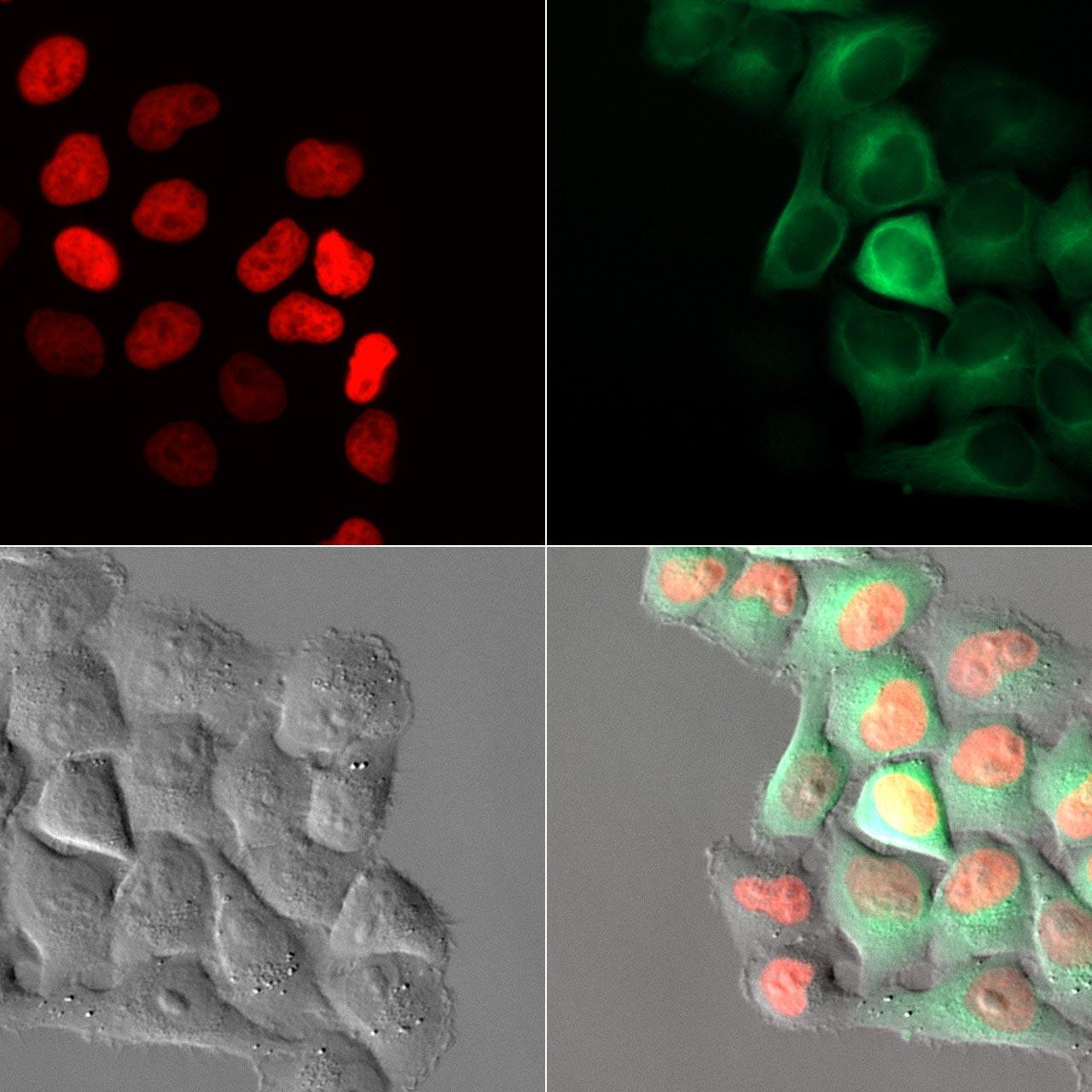 Images d'un essai de croissance de cellules HeLa Kyoto capturées toutes les 15 minutes pendant 72 heures avec la fonction Autoimmersion. 