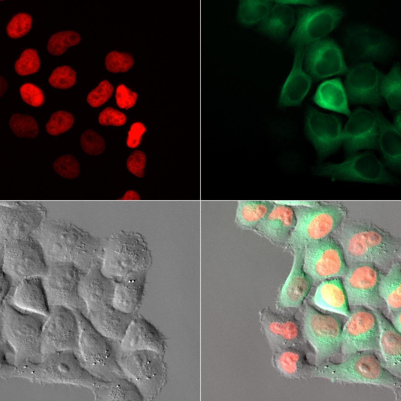 HeLa Kyoto cell growth assay imaged every 15 minutes for 72 hours using Autoimmersion. 