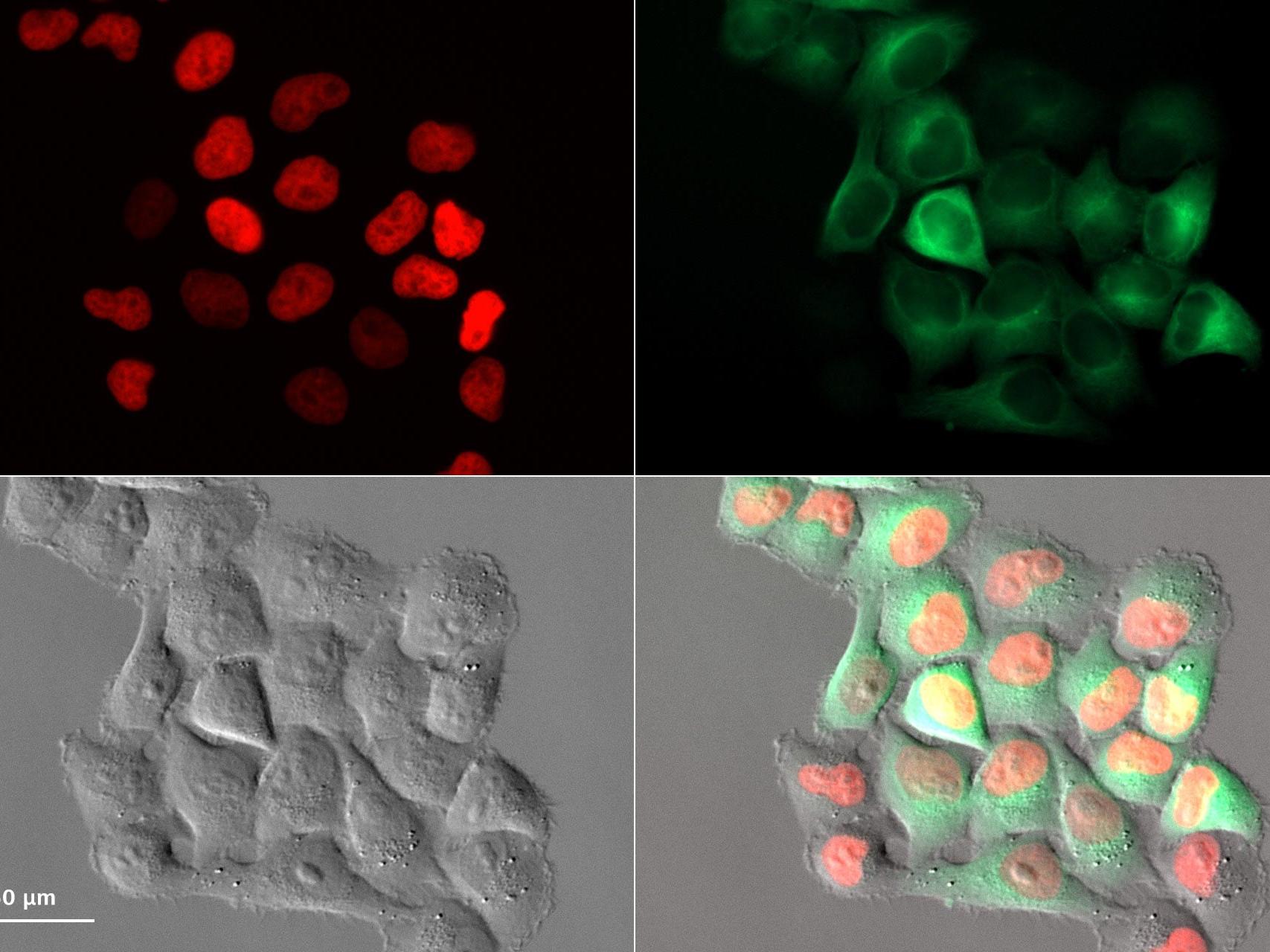 Images d'un essai de croissance de cellules HeLa Kyoto capturées toutes les 15 minutes pendant 72 heures avec la fonction Autoimmersion. 