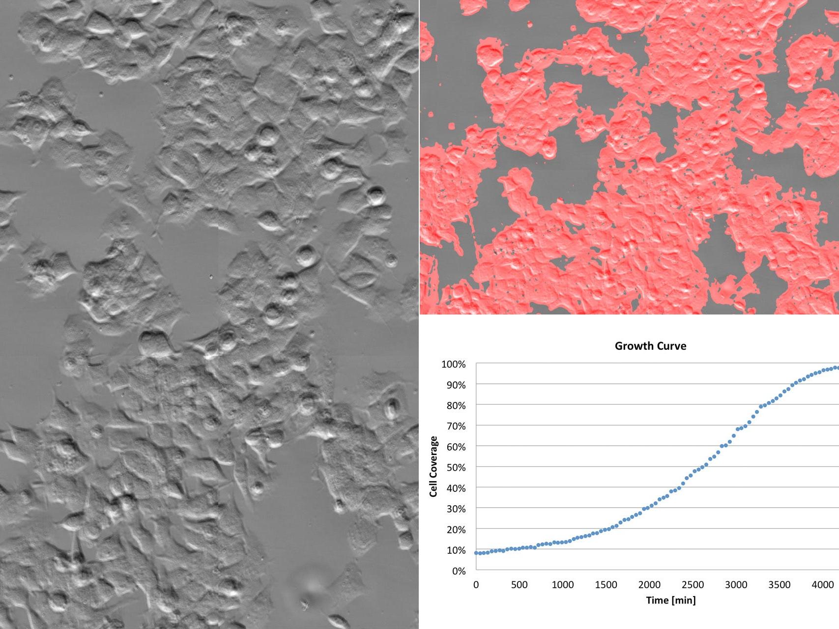 Images de la croissance de cellules cultivées capturées pendant 72 heures utilisant le contraste à gradient de phase. Afin de quantifier la prolifération, la région cellulaire a été détectée à l'aide de l'apprentissage automatique. La courbe de croissance indique la couverture relative des cellules dans le temps