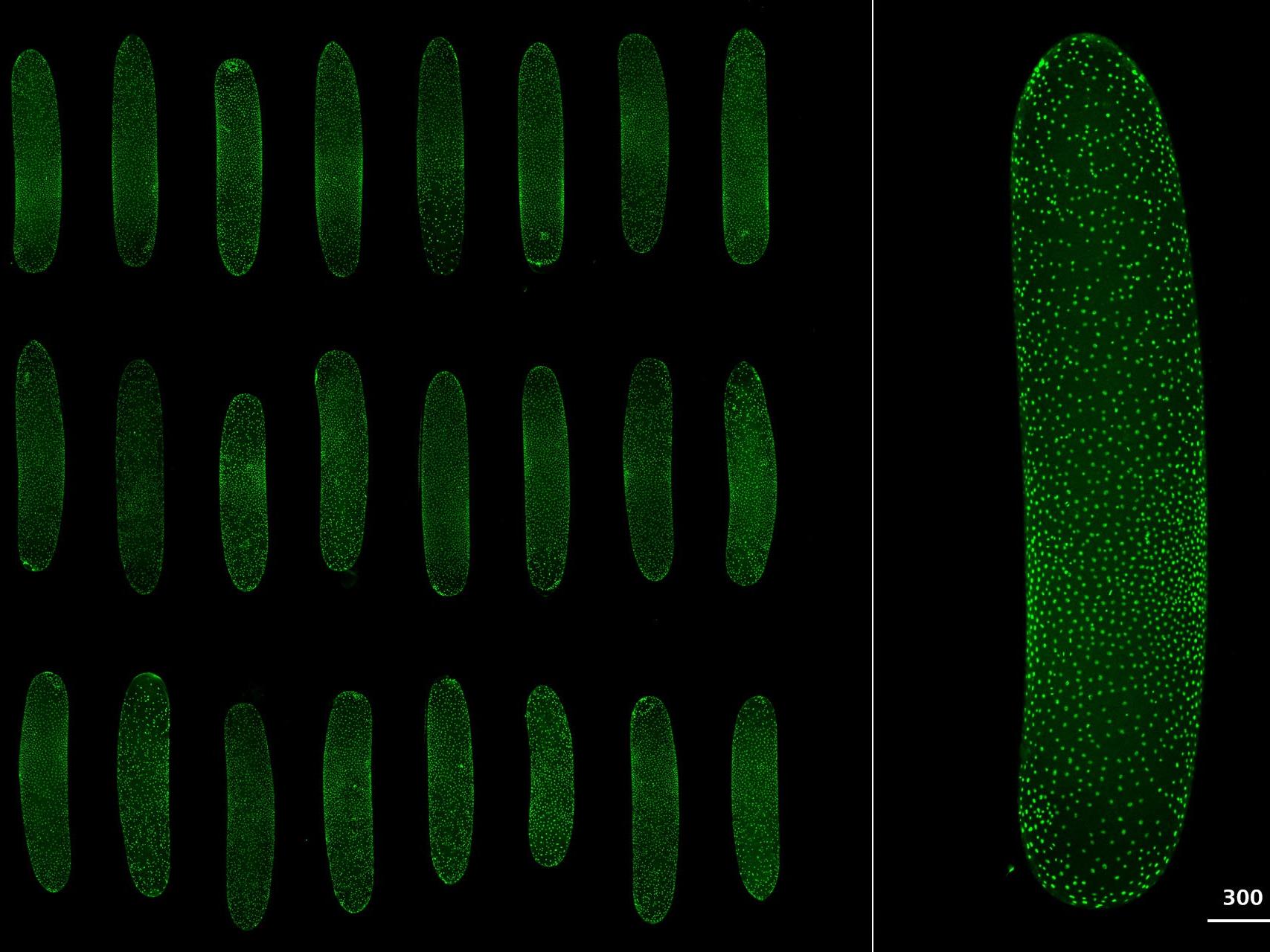 Lebende Grillenembryonen, fixiert in Agarose mit niedrigem Schmelzpunkt, Exprimierung von im Kern lokalisiertem GFP, Multipositionsexperiment.