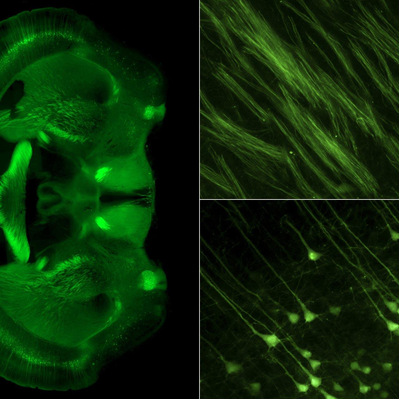 Microscopie d'expansion dans un cerveau de souris. À gauche : cerveau entier ; en haut à droite : faisceaux d'axones, en bas à droite : cellules pyramidales.