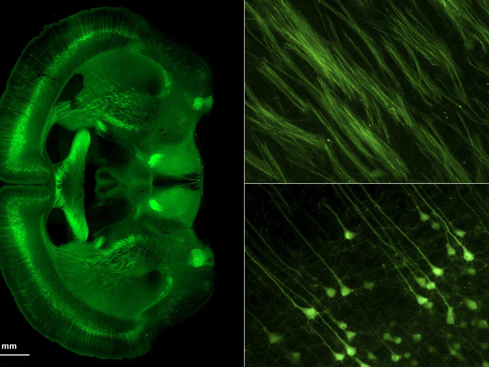 应用于小鼠脑内的膨胀显微技术。左：全脑；右上：轴突束，右下：锥体细胞。