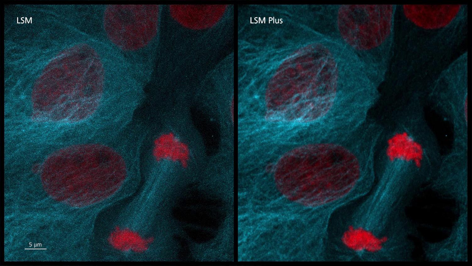 Confocal imaging of porcine kidney cell division using LSM Plus