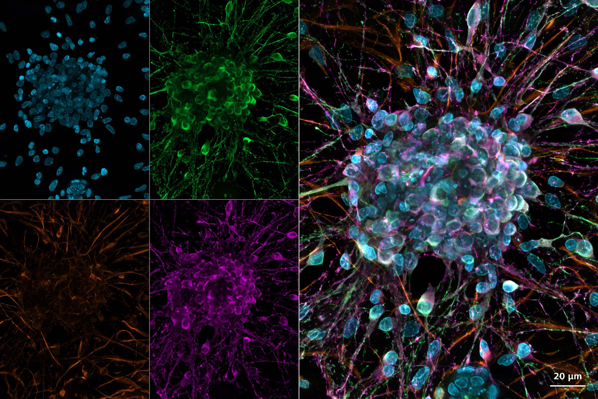 Rat cortical primary neuron culture. Deconvolved images using GPU-based deconvolution.
