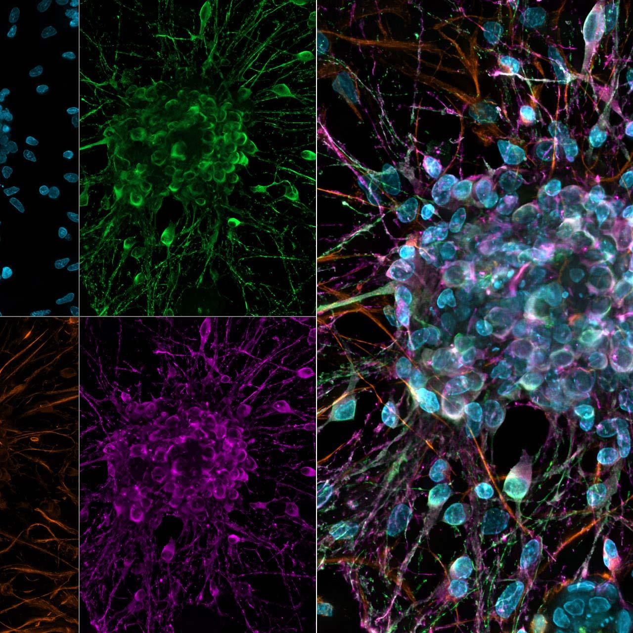 Cultivo de neuronas primarias corticales de rata. Imágenes sometidas a deconvolución basada en GPU.