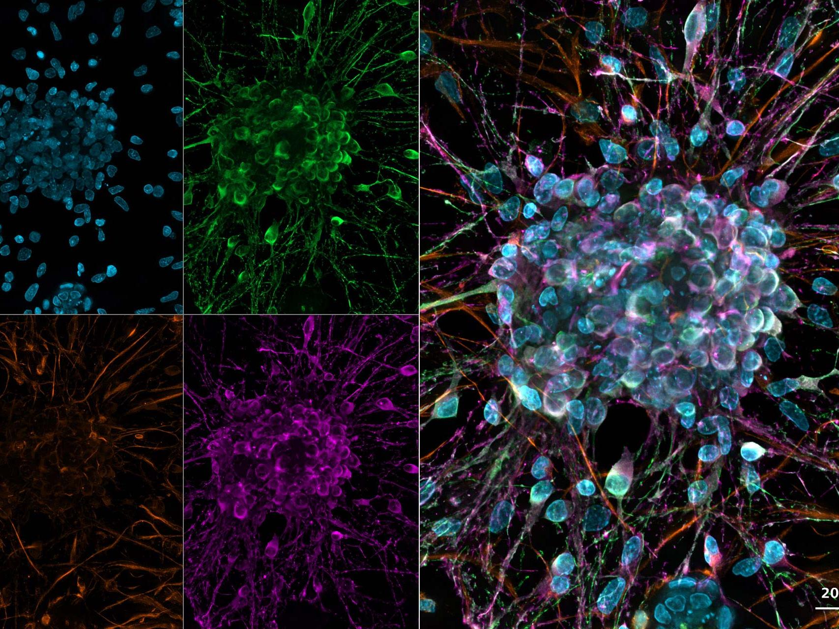 Cultivo de neuronas primarias corticales de rata. Imágenes sometidas a deconvolución basada en GPU.