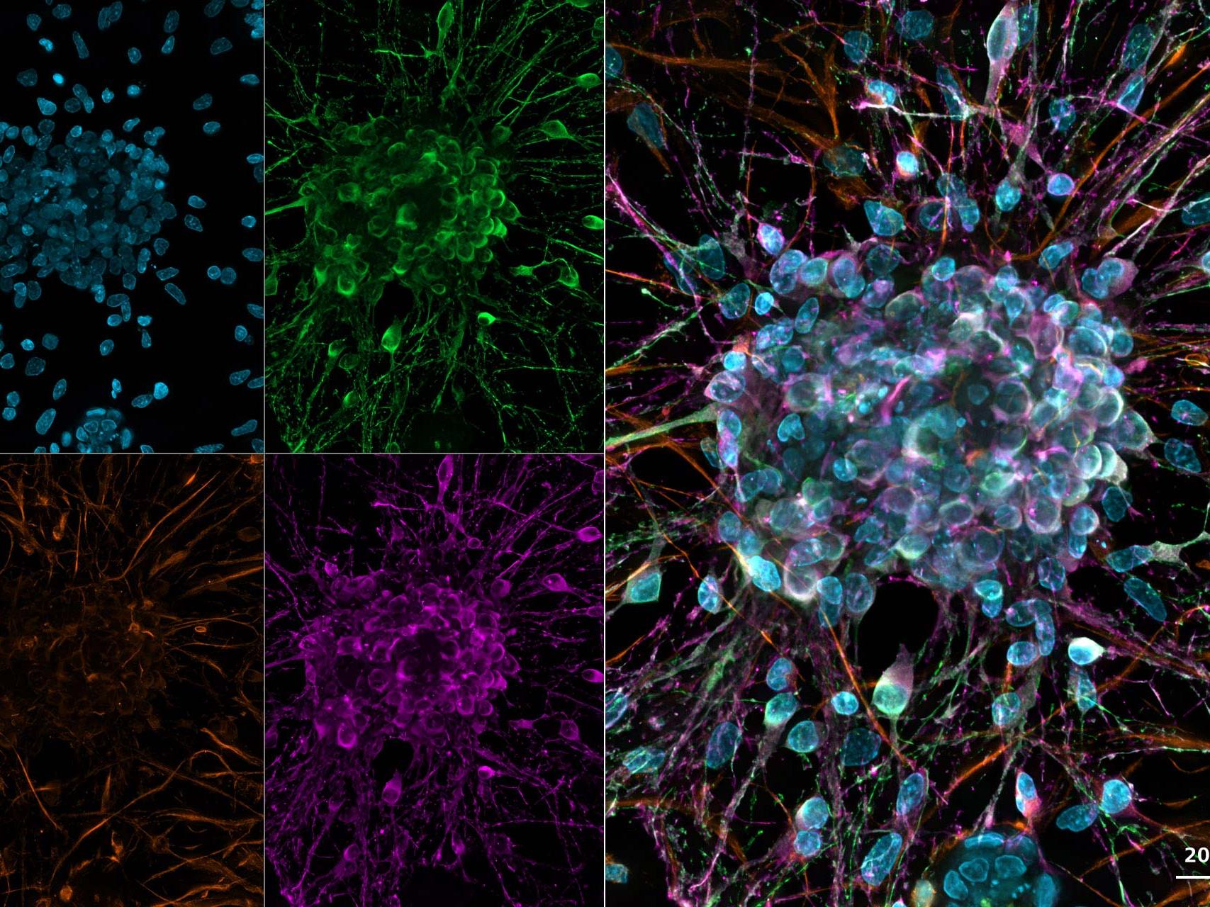 Rat cortical primary neuron culture. Deconvolved images using GPU-based deconvolution.