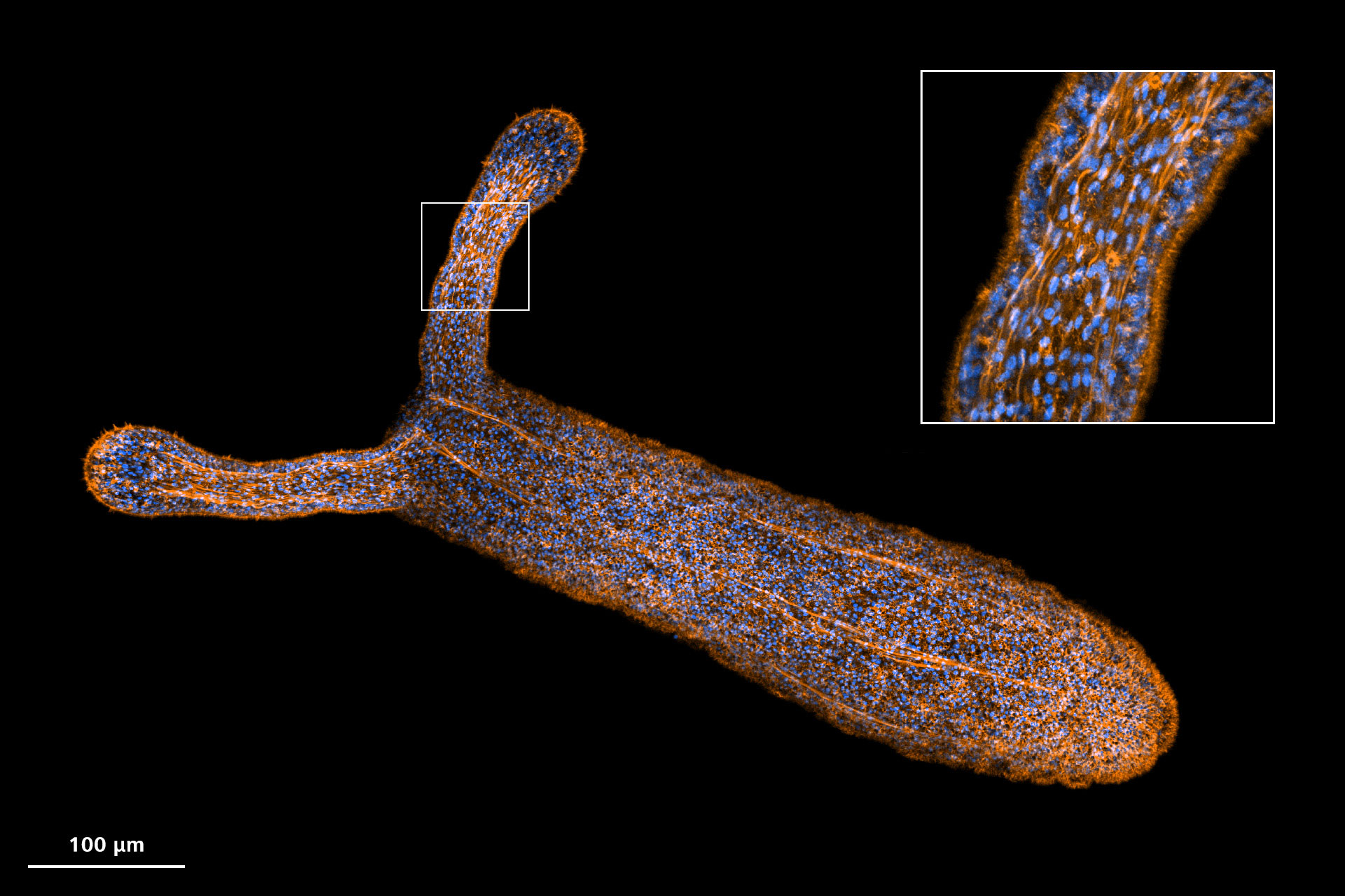 Starlet sea anemone (Nematostella vectensis) imaged with Airyscan 2 high sensitivity mode.
