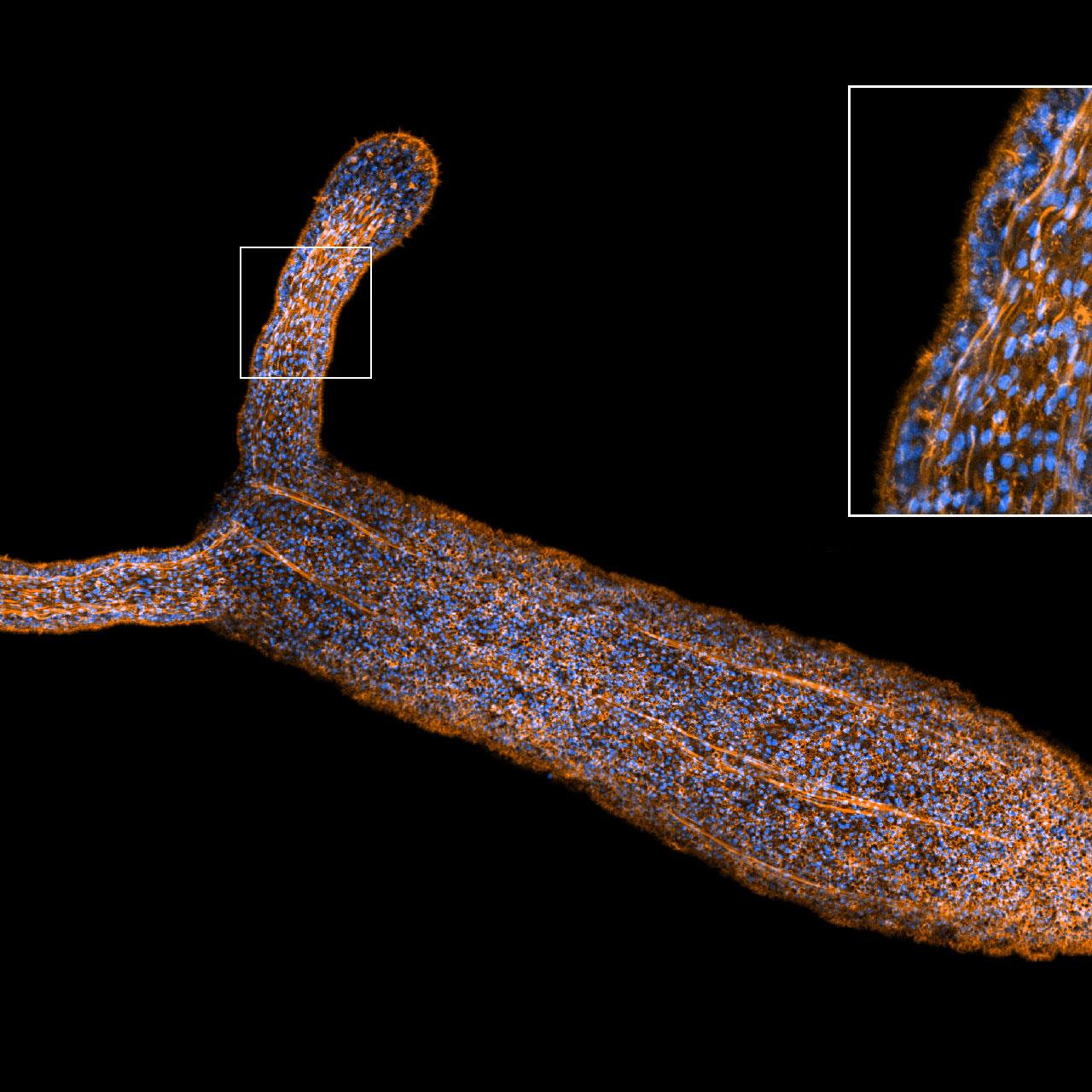 Anémona de mar estrella (Nematostella vectensis) captada con el modo de alta sensibilidad de Airyscan 2.