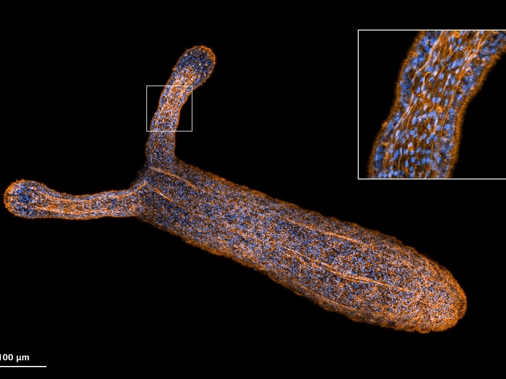 Image d'une anémone de mer (Nematostella vectensis) capturée avec Airyscan 2 en mode haute sensibilité.
