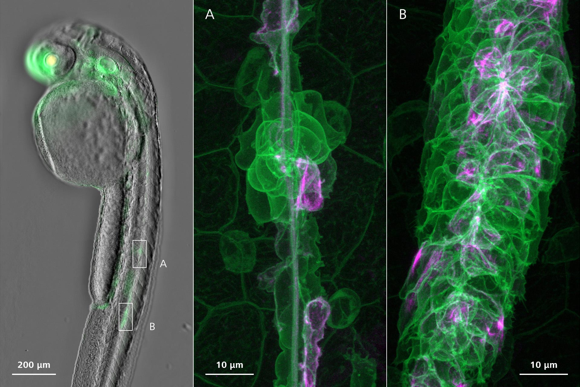 Lateral line primordium migration and deposition of immature neuromasts in a Zebrafish embryo. Overview image: Phase Gradient Contrast with fluorescence acquisition. High-resolution images: Airyscan 2 Multiplex.