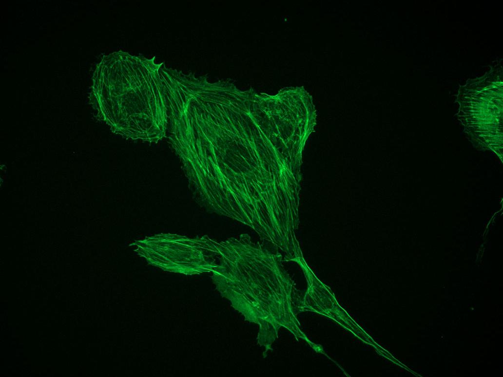 Misma estructura usando un objetivo Autocorr. Tubulina en la diapositiva n.º 1 preparada con FluoCells. 