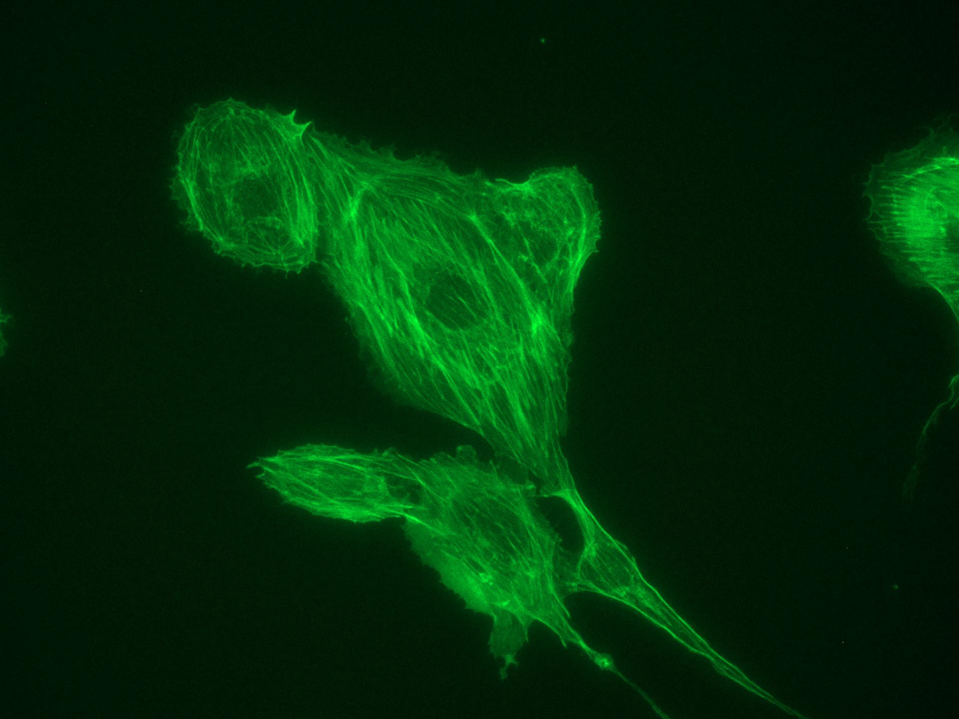 Aberration sphérique due à un mauvais réglage de l'optique. Lame n° 1 préparée avec tubuline dans FluoCells. 