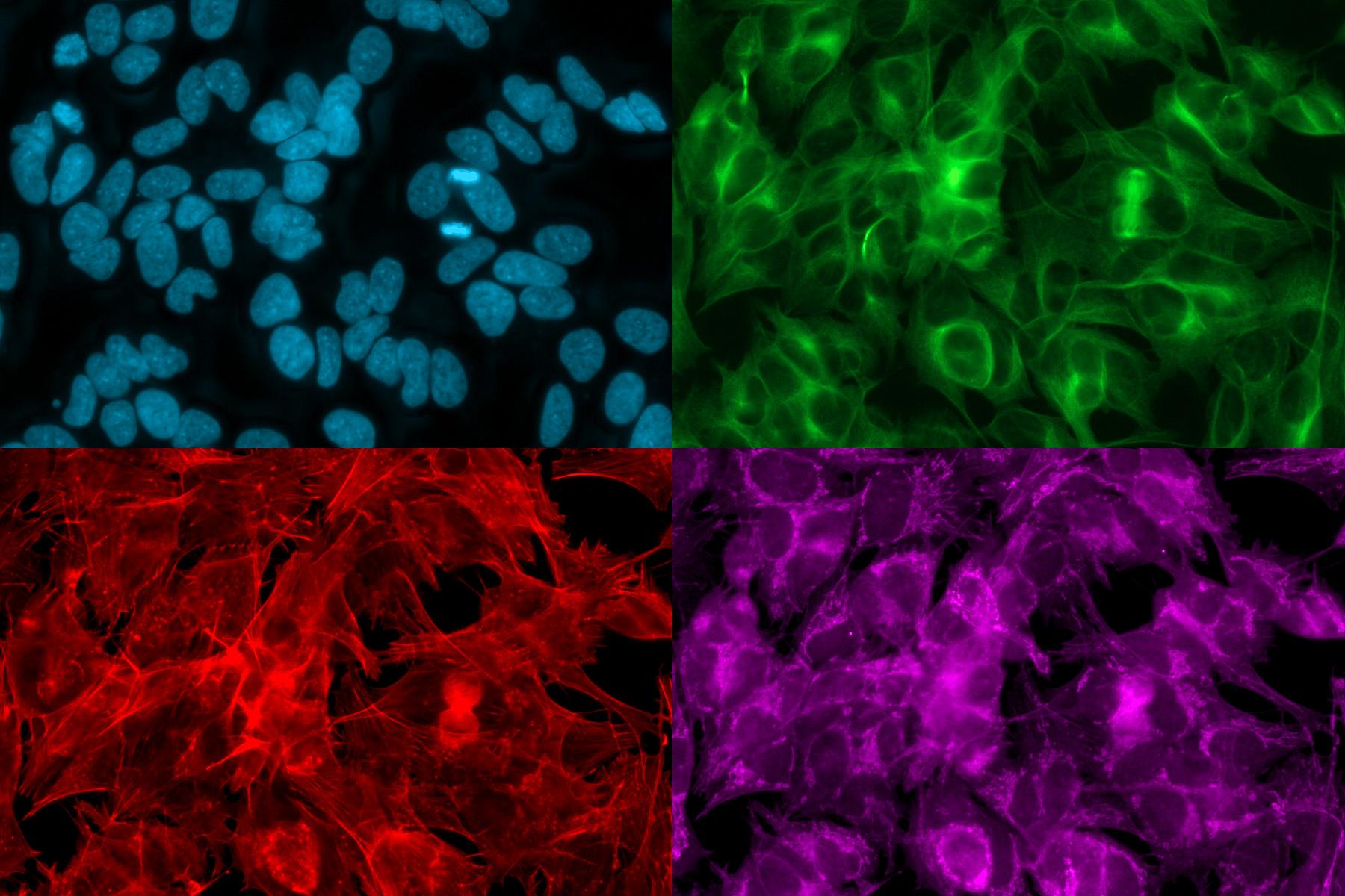 SH-SY5Y cells cultured on a 384 micro-well plate; multichannel image at a single position. Hoechst – Chromatin (blue), anti-alpha-tubulin antibody FITC for alphas tubulin (green), Phalloidine for actin (red), MitoTracker Deep Red for mitochondria (purple). Sample courtesy of P. Denner, Core Research Facilities, German Center of Neuro-degenerative Diseases (DZNE), Bonn, Germany.